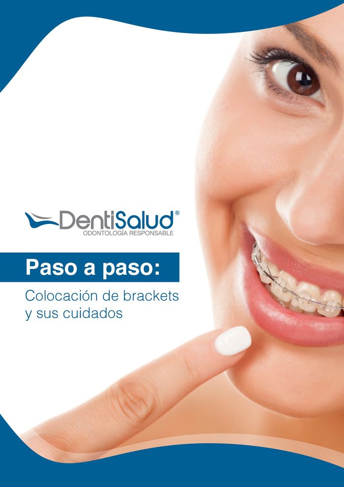 Catálogo Dentisalud en Bogotá | Colocación de Brackets | 9/5/2024 - 31/12/2024